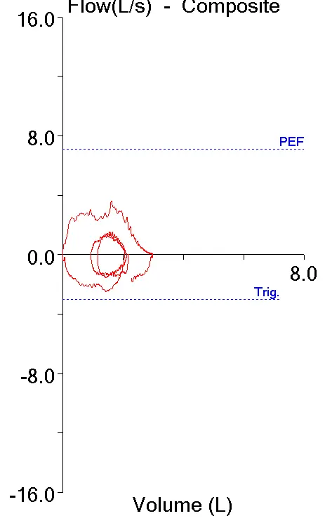 Back_extrapolation_04_redacted