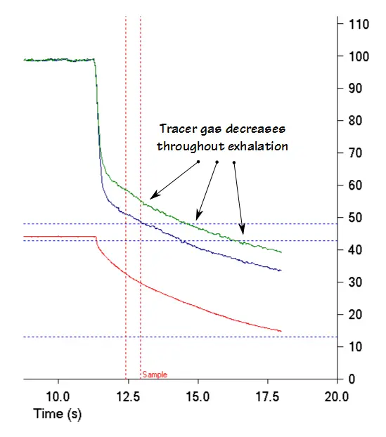 COPD_Exhaled_CH4_Declines