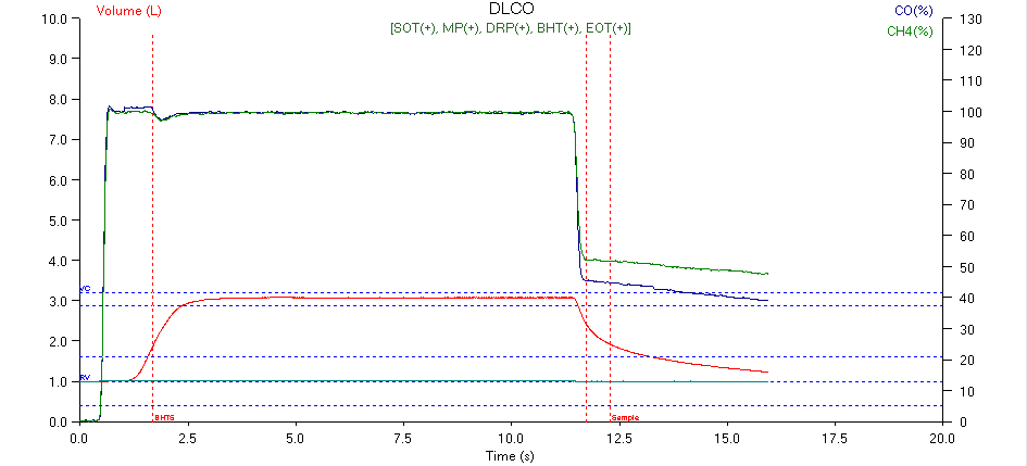 DL_Gain_Error_01_Graph_Datasheet_Cropped_2b