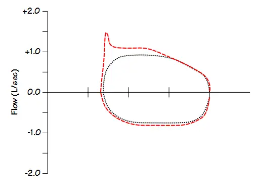EFLt_Partial