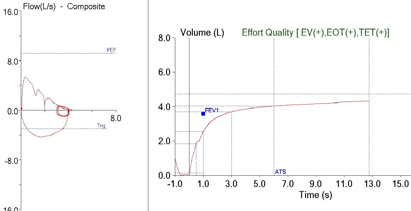 Early pause affecting FEV1