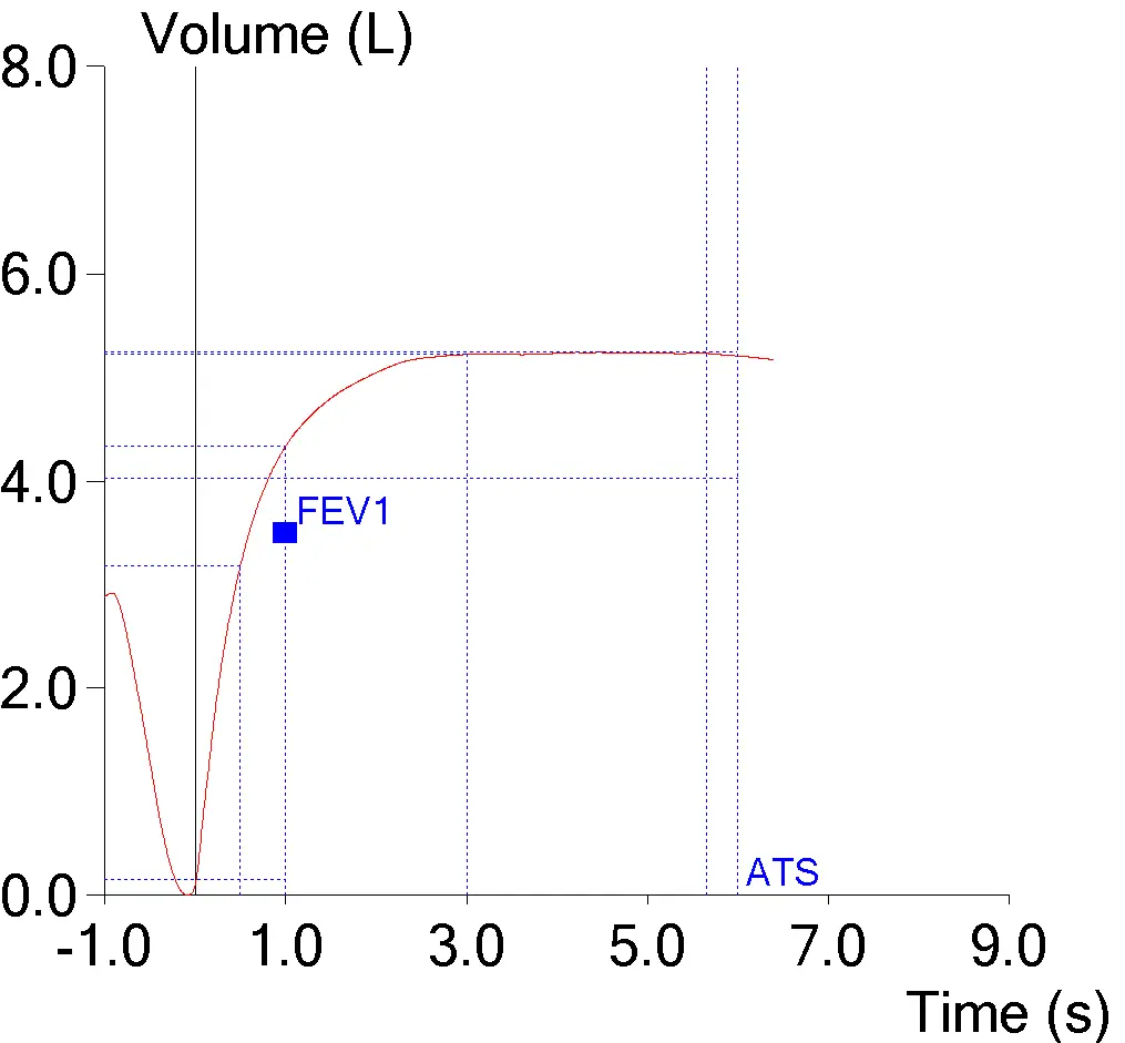 Early_Termination_01_V-T