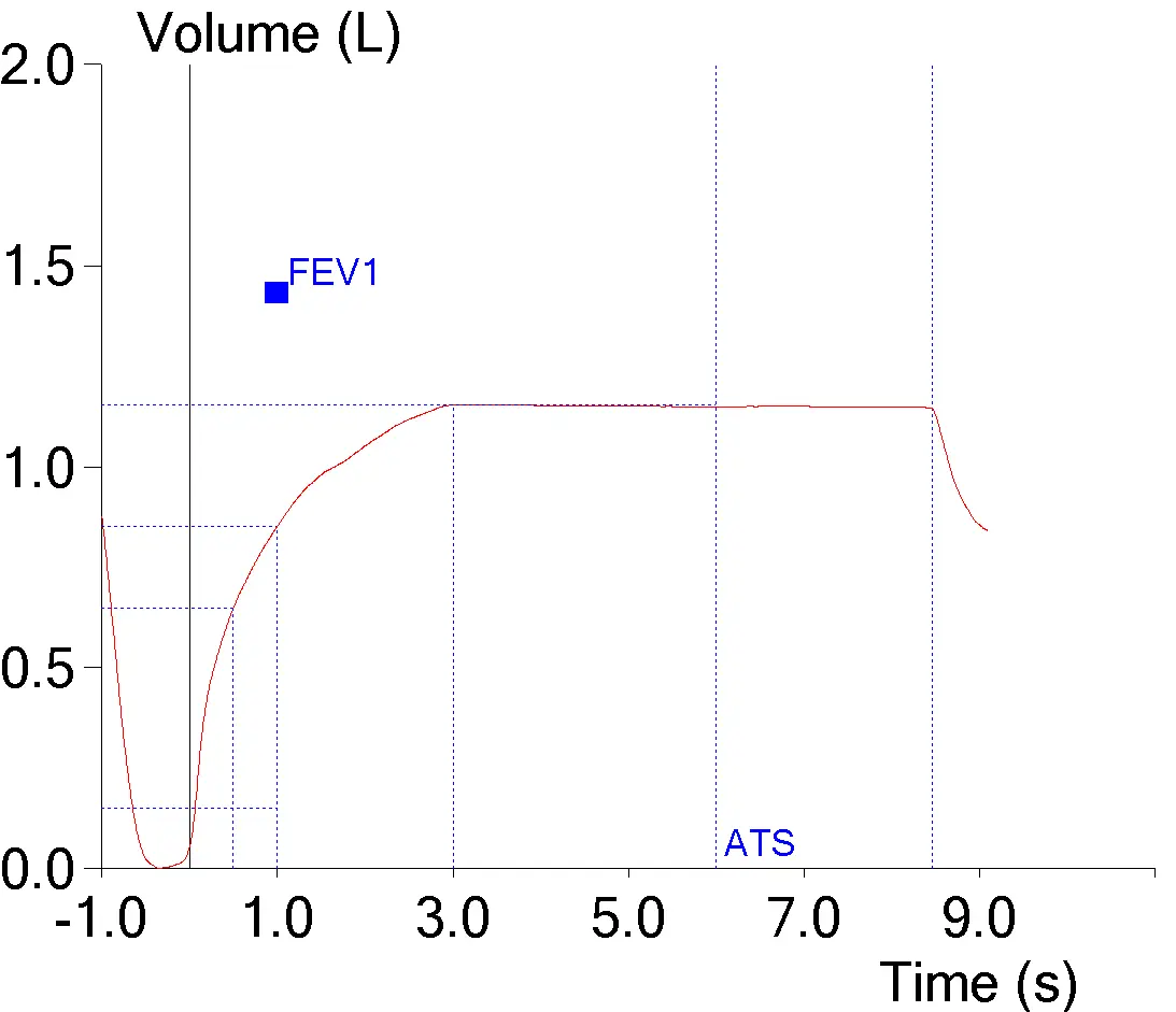Early_Termination_02_V-T