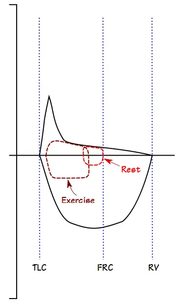 Exercise FVL COPD