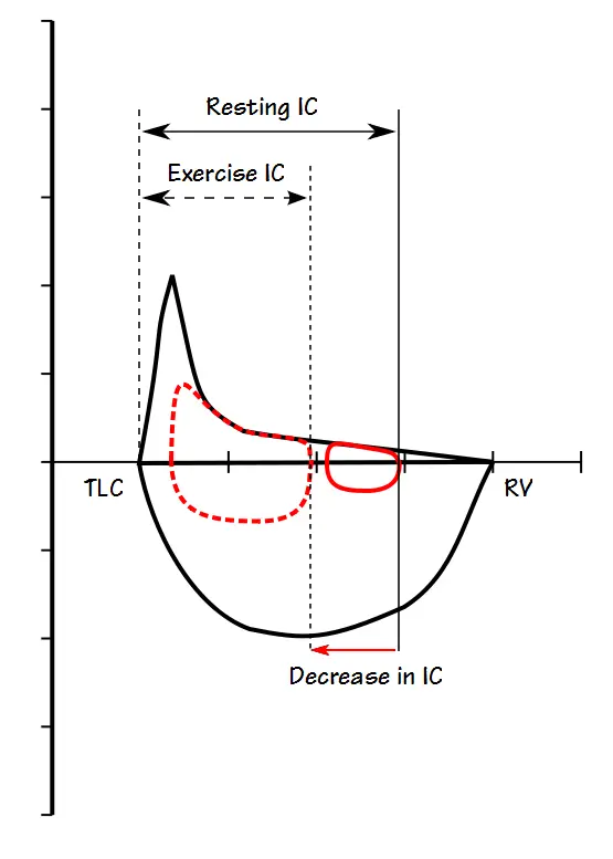Exercise IC