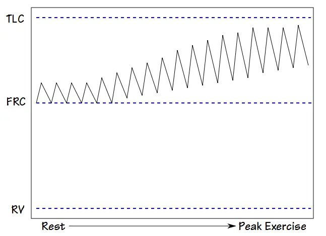 Exercise_VT_COPD