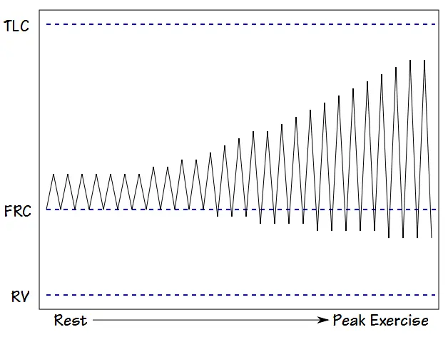 Exercise_VT_Normal