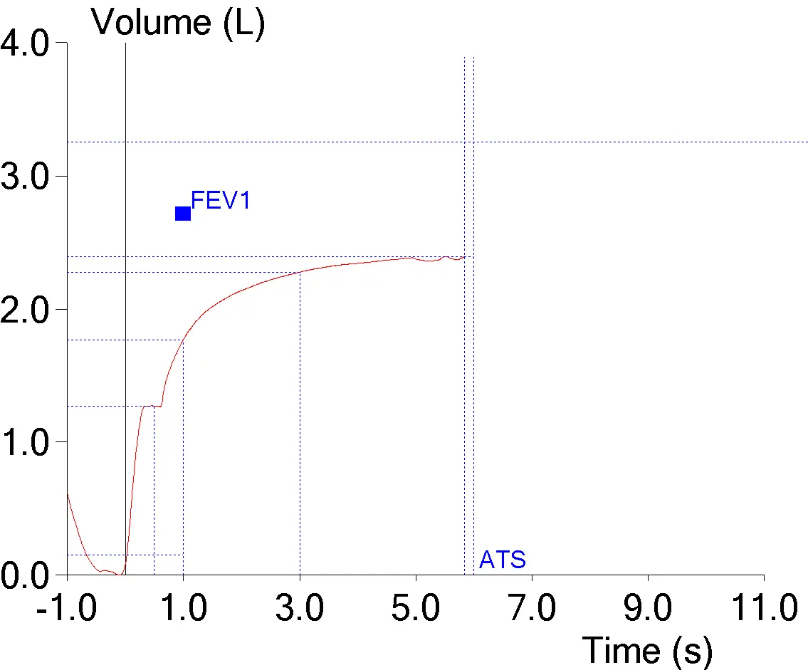 expiratory_pause_fev1_underestimated_vt_2