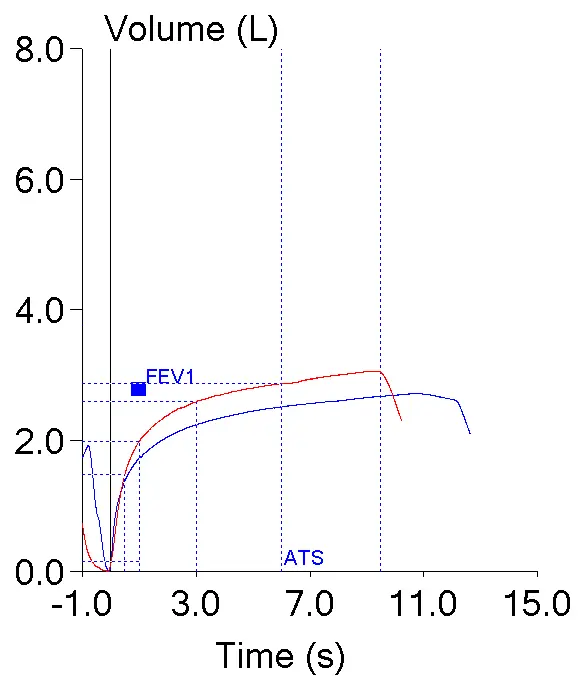 FEV1_vs_PEF_V-T
