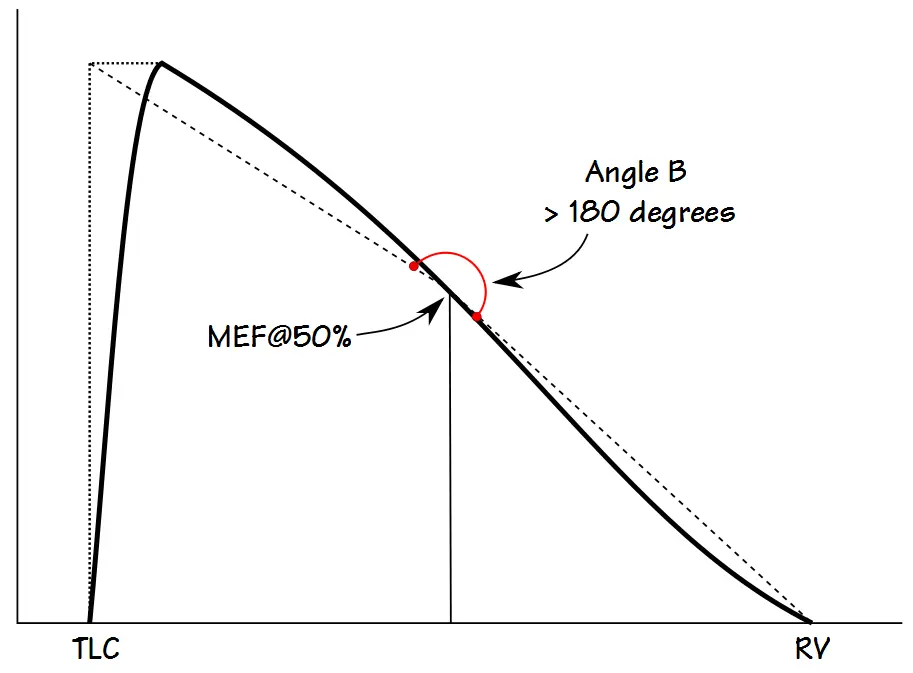 FVL_Angle_Convex