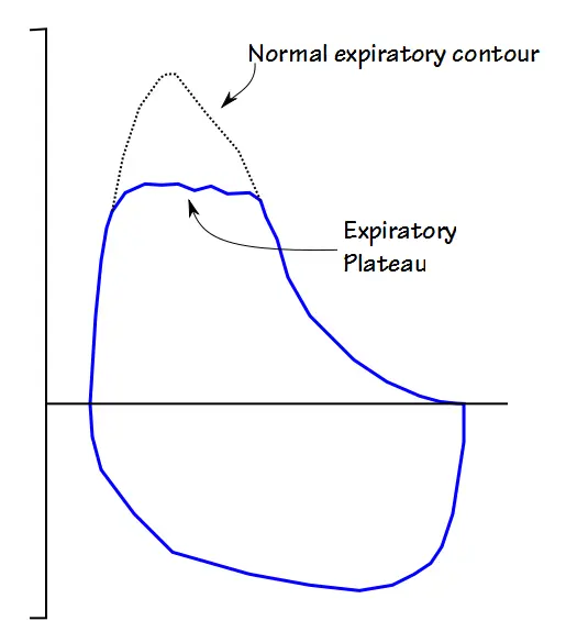 FVL_Expiratory_Plateau