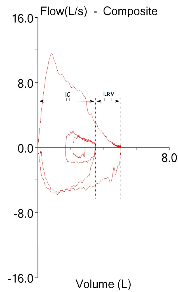 FVL_IC_ERV