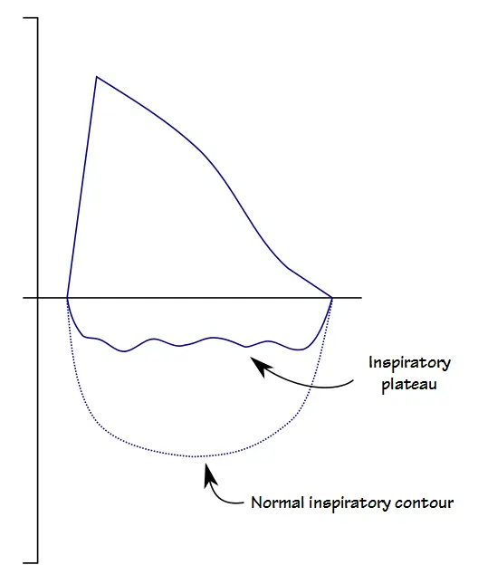 FVL_Inspiratory_Plateau