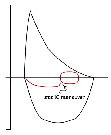 FVL_Late_IC