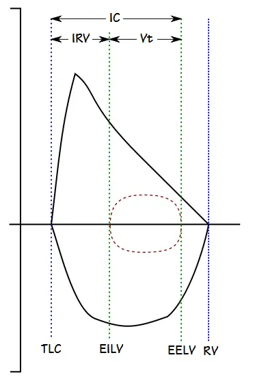 FVL_Lung_Volume_Subdivisions