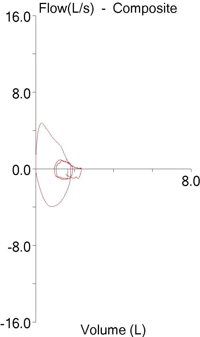 FVL_Scaling_05
