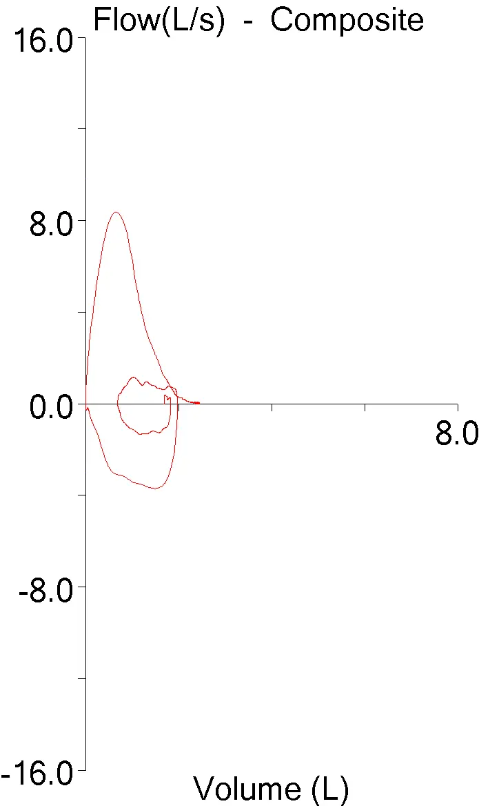 FVL_Scaling_07