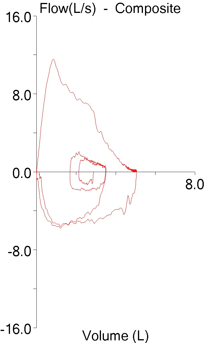 FVL_Scaling_08