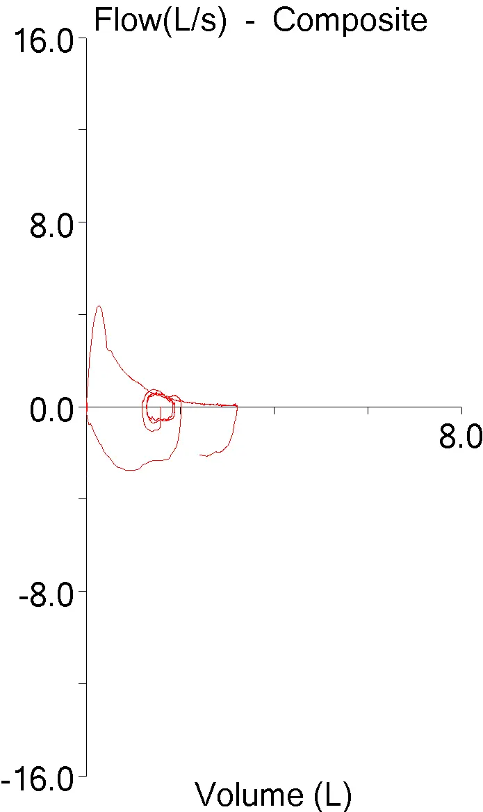 FVL_Scaling_09