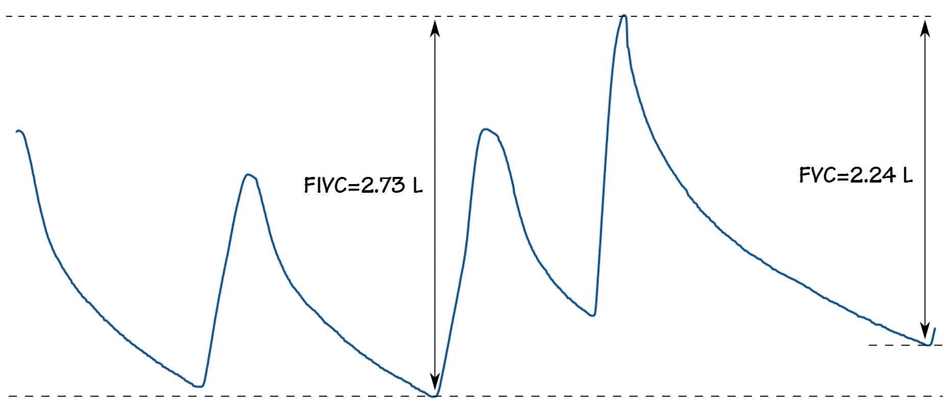 Hidden_FIVC_2_VT2