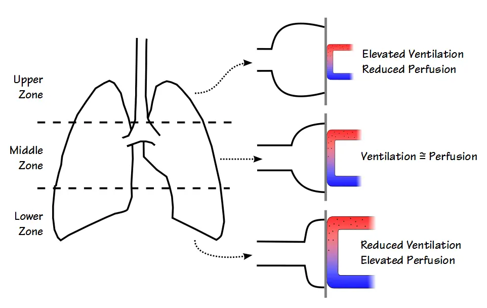 Lung Zones