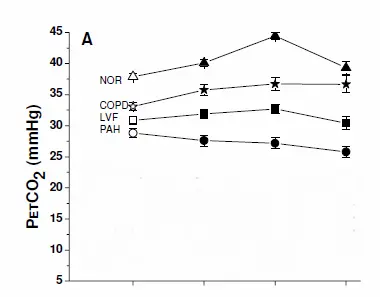 PETCO2 during exercise PETCO2_Graph