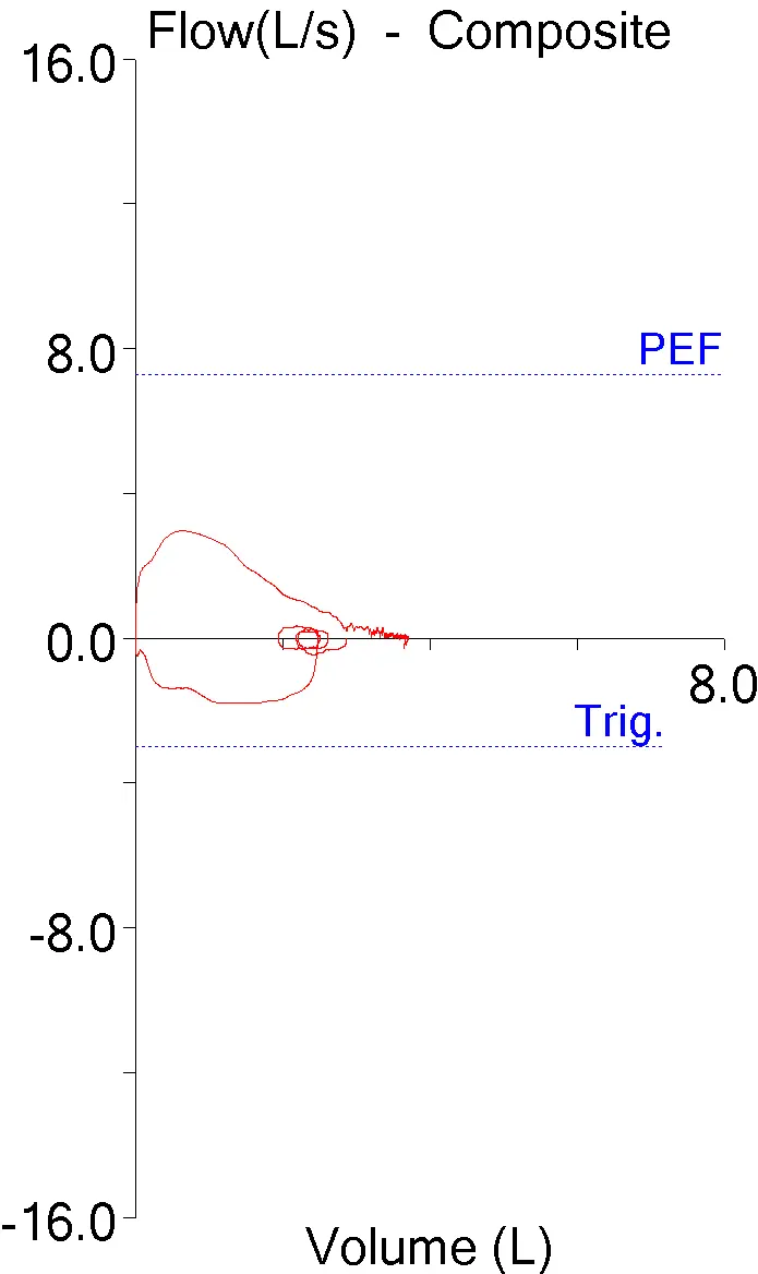 Peak_Flow_1