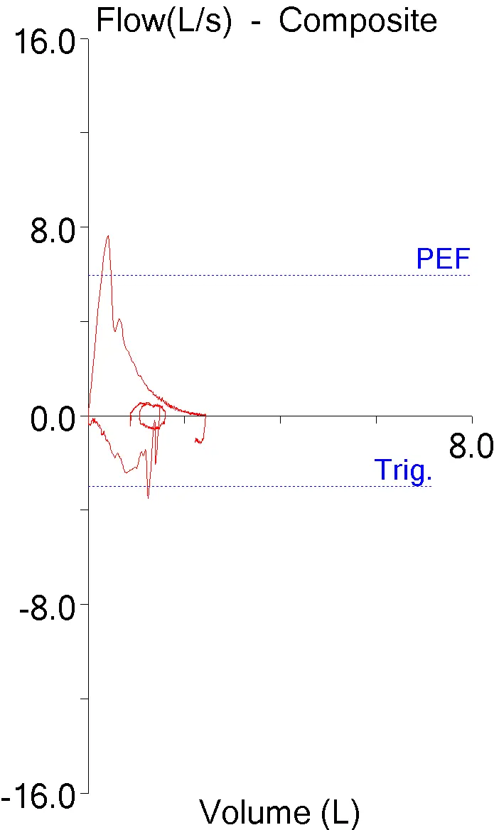 Peak_Flow_2