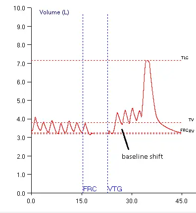 TGV_Baseline_Shift2