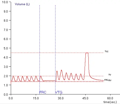 TGV_Baseline_Shift_Maybe_1