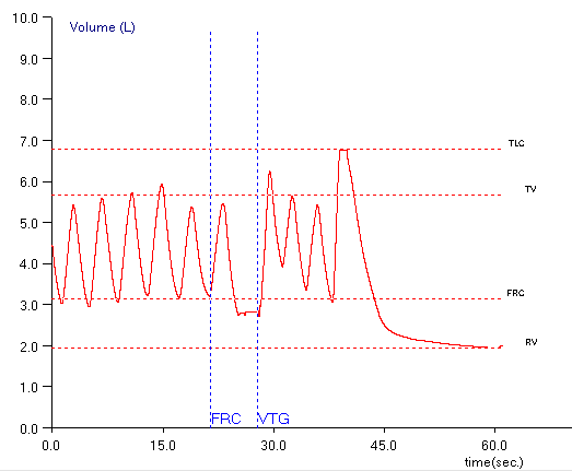 TGV_Baseline_Shift_Maybe_2
