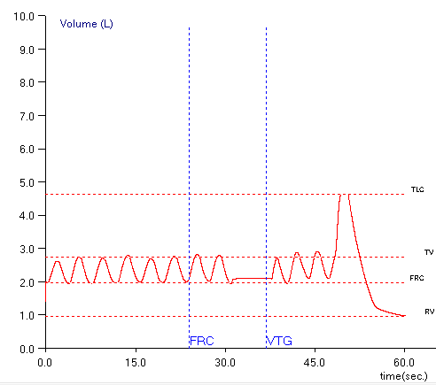 TGV_Baseline_Shift_Maybe_3