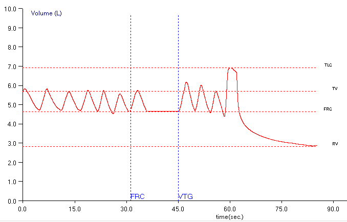 TGV_Baseline_Shift_Maybe_6