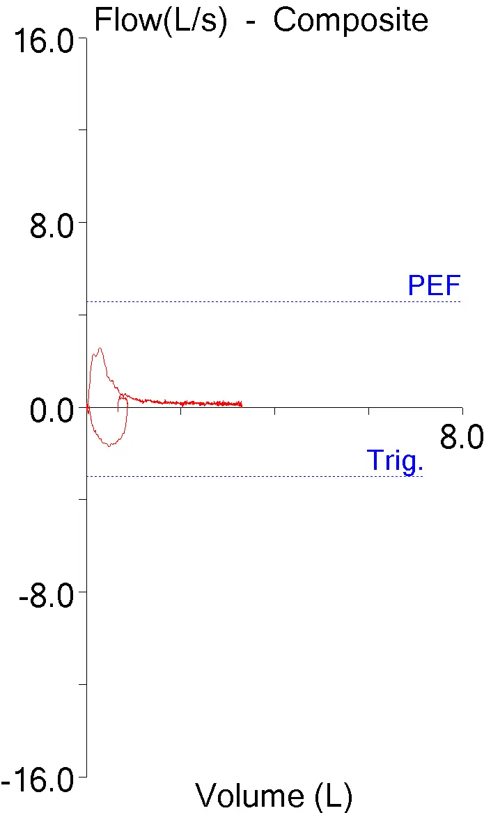 Transtracheal_O2_FVL