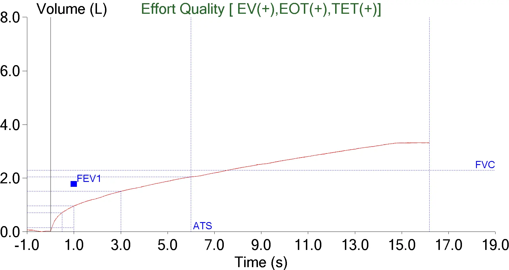 Transtracheal_O2_VT_Curve