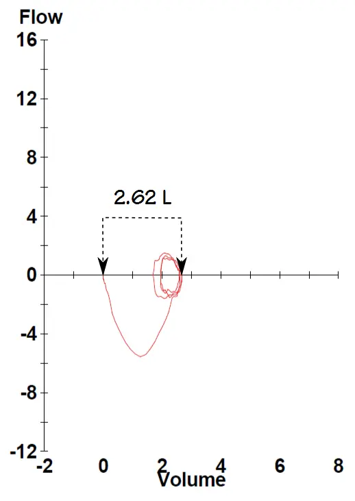 IC maneuver from level 1