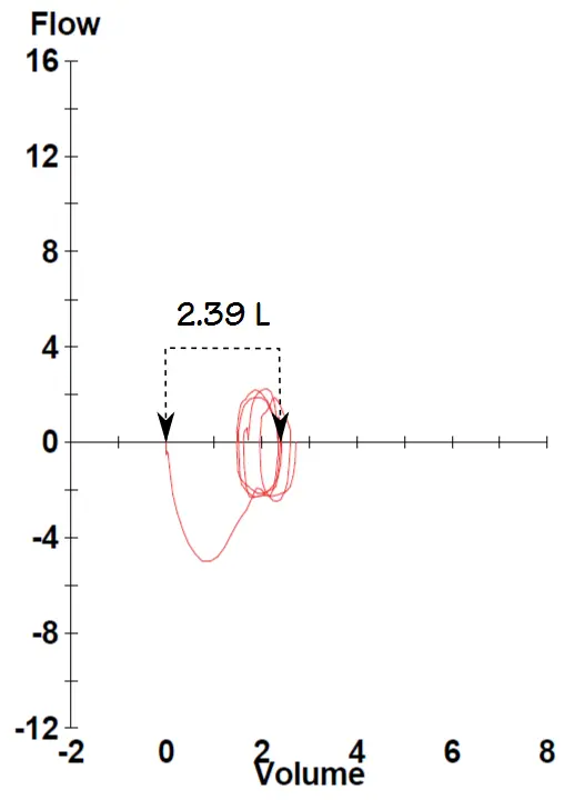 IC maneuver from exercise level 2