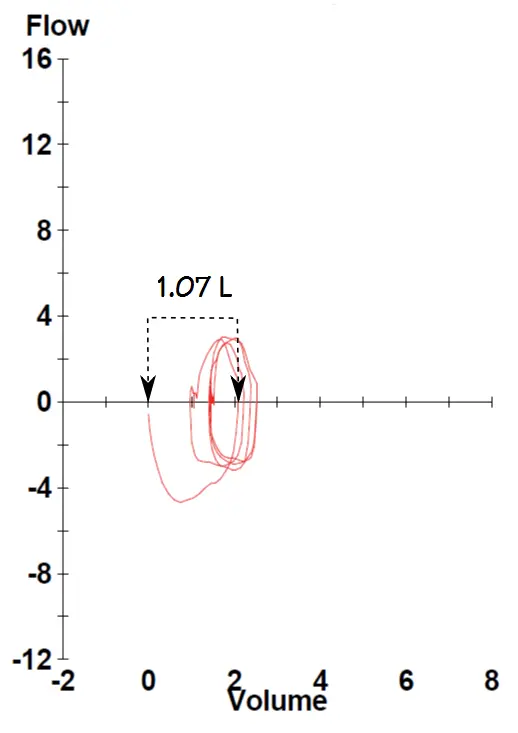 IC maneuver from exercise level 3